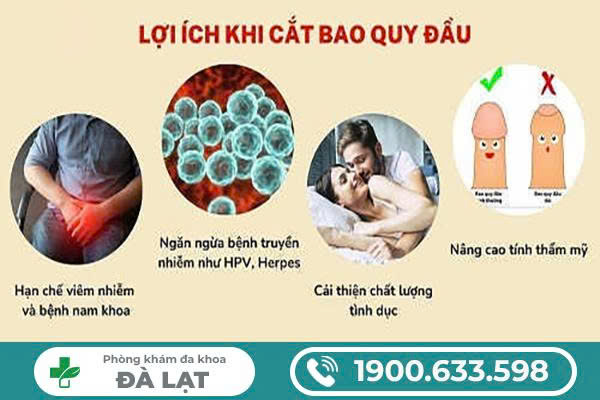 Hình ảnh minh họa